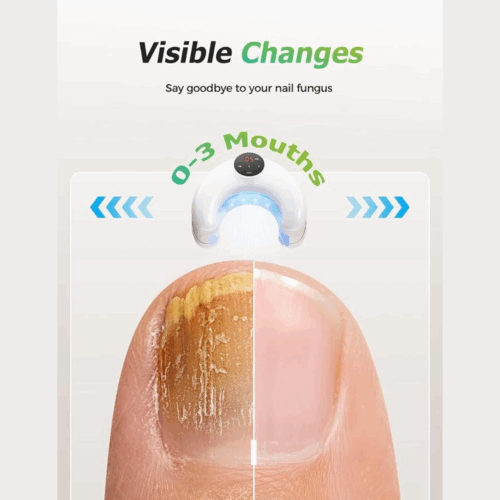 Fungabeam (official Retailer) 2025