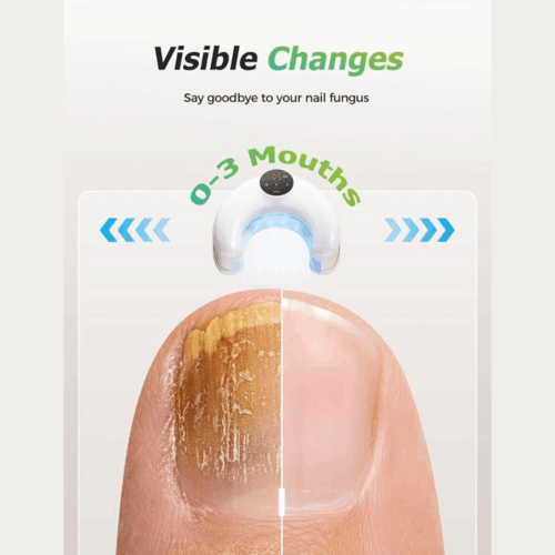 DermaBlue (official Retailer)