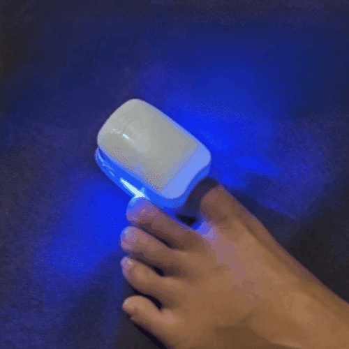 Dermablue (Upgraded Version [year]) - Official Retailer